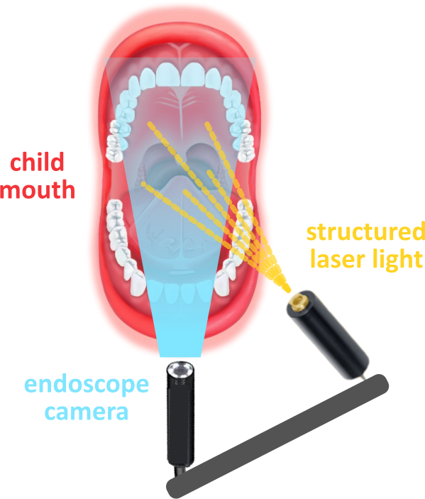 Mouth 3D device